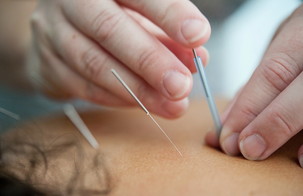 Dry Needling  Centennial, CO 